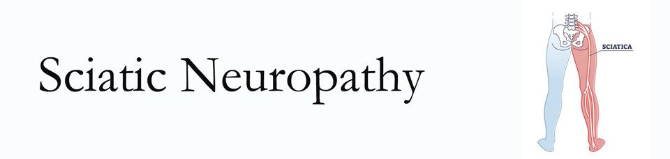 Ashburn neuropathy pain (sciatica) 