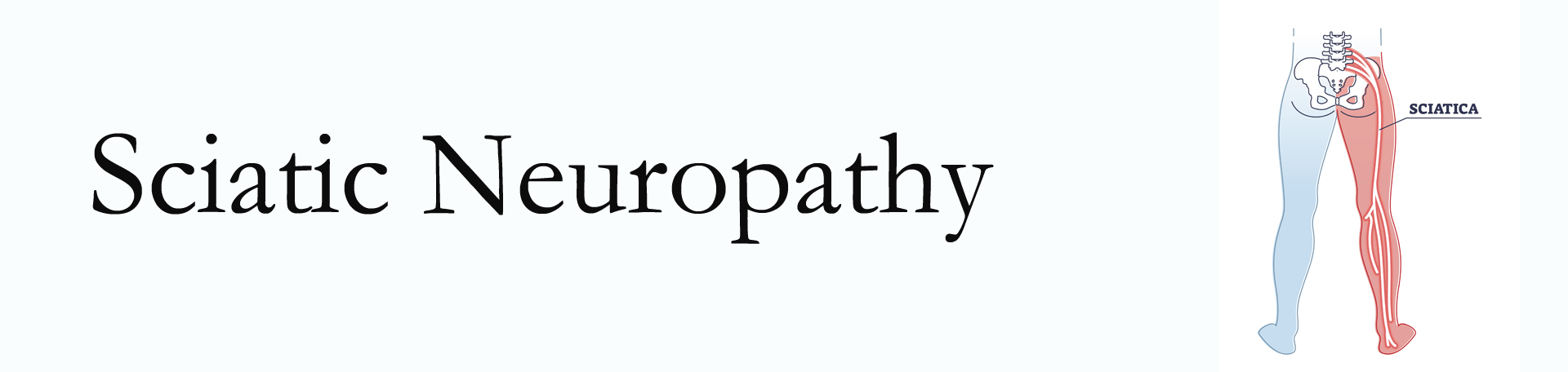 Ashburn and Herndon neuropathy pain (sciatica) 