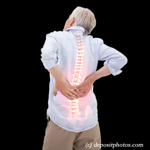 image Ashburn back pain with lumbar spinal stenosis